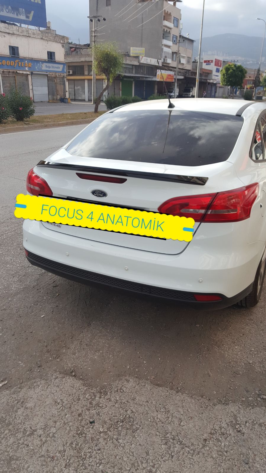 Bagaj Anatomik